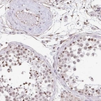 Immunohistochemical staining of human testis shows high expression.