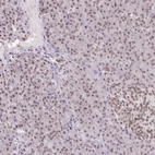 Immunohistochemical staining of human pancreas shows low expression as expected.