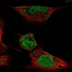 Immunofluorescent staining of human cell line U-251 MG shows localization to nucleus.