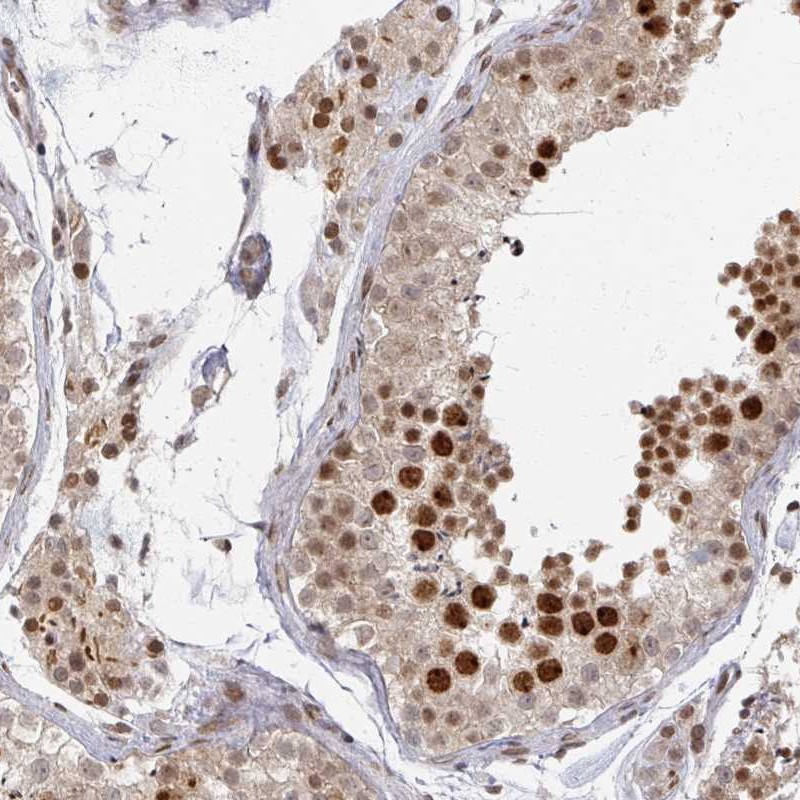 Anti-PSKH1 Antibody