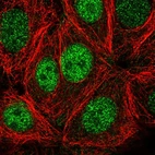 Immunofluorescent staining of human cell line MCF7 shows localization to nucleoplasm.