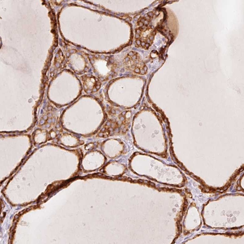 Anti-OR13C3 Antibody