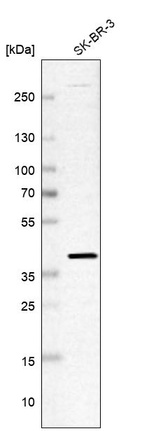 Anti-RTFDC1 Antibody