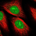 Immunofluorescent staining of human cell line HeLa shows localization to nucleus & nucleoli.