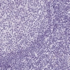 Immunohistochemical staining of humantonsil shows no positivity in non-germinal center cells as expected.