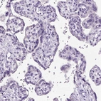 Immunohistochemical staining of human placenta shows no positivity in trophoblastic cells as expected.