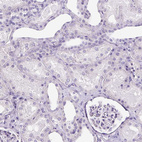 Immunohistochemical staining of human kidney shows no positivity in cells in tubules as expected.