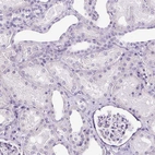 Immunohistochemical staining of human kidney shows no positivity in cells in tubules as expected.