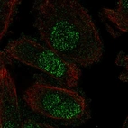 Immunofluorescent staining of human cell line PC-3 shows localization to nucleus.