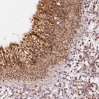 Anti-ZNF580 Antibody