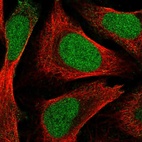 Immunofluorescent staining of human cell line U-2 OS shows localization to nucleus.