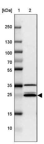 Lane 1: Marker [kDa] 250, 130, 100, 70, 55, 35, 25, 15, 10_br/_Lane 2: Human cell line CACO-2
