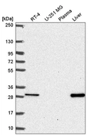 Western blot analysis in human cell line RT-4, human cell line U-251 MG, human plasma and human liver tissue.