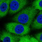 Immunofluorescent staining of human cell line MCF7 shows localization to cytosol.