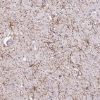 Anti-VWA7 Antibody