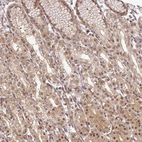 Anti-FAM192A Antibody