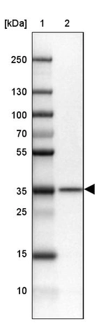 Lane 1: Marker [kDa] 250, 130, 100, 70, 55, 35, 25, 15, 10_br/_Lane 2: Human cell line MOLT-4