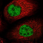 Immunofluorescent staining of human cell line A-431 shows localization to nucleoplasm.