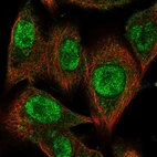Immunofluorescent staining of human cell line A549 shows localization to nucleoplasm & cytosol.