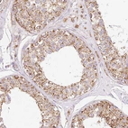 Immunohistochemical staining of human testis shows strong cytoplasmic granular positivity in cells in seminiferous ducts and leydig cells.