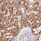Immunohistochemical staining of human kidney shows strong cytoplasmic granular positivity in cells in tubules.