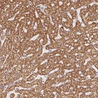 Immunohistochemical staining of human liver shows strong cytoplasmic granular positivity in hepatocytes.
