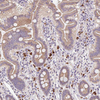 Anti-TNFRSF10A Antibody