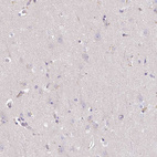 Anti-TNFRSF10A Antibody