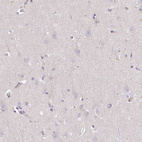 Immunohistochemical staining of human cerebral cortex shows no positivity in neurons as expected.