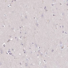 Immunohistochemical staining of human cerebral cortex shows no positivity in neurons as expected.