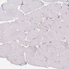Immunohistochemical staining of human skeletal muscle shows no positivity in myocytes as expected.