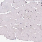 Immunohistochemical staining of human skeletal muscle shows no positivity in myocytes as expected.