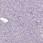Immunohistochemical staining of human pancreas shows no positivity in exocrine glandular cells as expected.