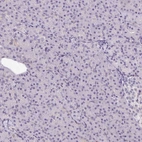 Immunohistochemical staining of human pancreas shows no positivity in exocrine glandular cells as expected.