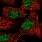 Immunofluorescent staining of human cell line A549 shows localization to nucleus.
