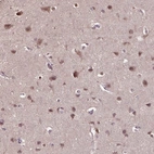 Anti-WDR17 Antibody