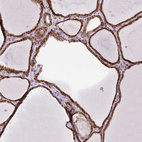 Immunohistochemical staining of human thyroid gland shows strong granular cytoplasmic positivity in glandular cells.