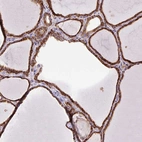 Immunohistochemical staining of human thyroid gland shows strong granular cytoplasmic positivity in glandular cells.