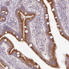 Immunohistochemical staining of human duodenum shows strong granular cytoplasmic positivity in glandular cells.