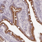 Immunohistochemical staining of human duodenum shows strong granular cytoplasmic positivity in glandular cells.