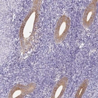 Immunohistochemical staining of human endometrium shows moderate granular cytoplasmic positivity in glandular cells.