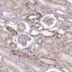 Immunohistochemical staining of human kidney shows strong granular cytoplasmic positivity in in a subset of cells in tubules.
