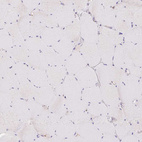 Immunohistochemical staining of human skeletal muscle shows no granular cytoplasmic positivity in myocytes.