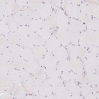 Immunohistochemical staining of human skeletal muscle shows no granular cytoplasmic positivity in myocytes.