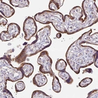 Anti-SKP2 Antibody