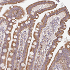 Immunohistochemical staining of human duodenum shows moderate cytoplasmic positivity in glandular cells.