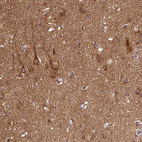 Immunohistochemical staining of human cerebral cortex shows moderate to strong cytoplasmic positivity in neurons.