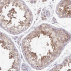Immunohistochemical staining of human testis shows moderate to strong cytoplasmic positivity in cells in seminiferous ducts.