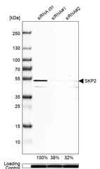 Western blot analysis in Rh30 cells transfected with control siRNA, target specific siRNA probe #1 and #2, using Anti-SKP2 antibody. Remaining relative intensity is presented. Loading control: Anti-GAPDH.