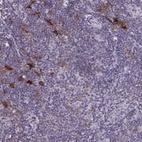 Anti-SNX11 Antibody